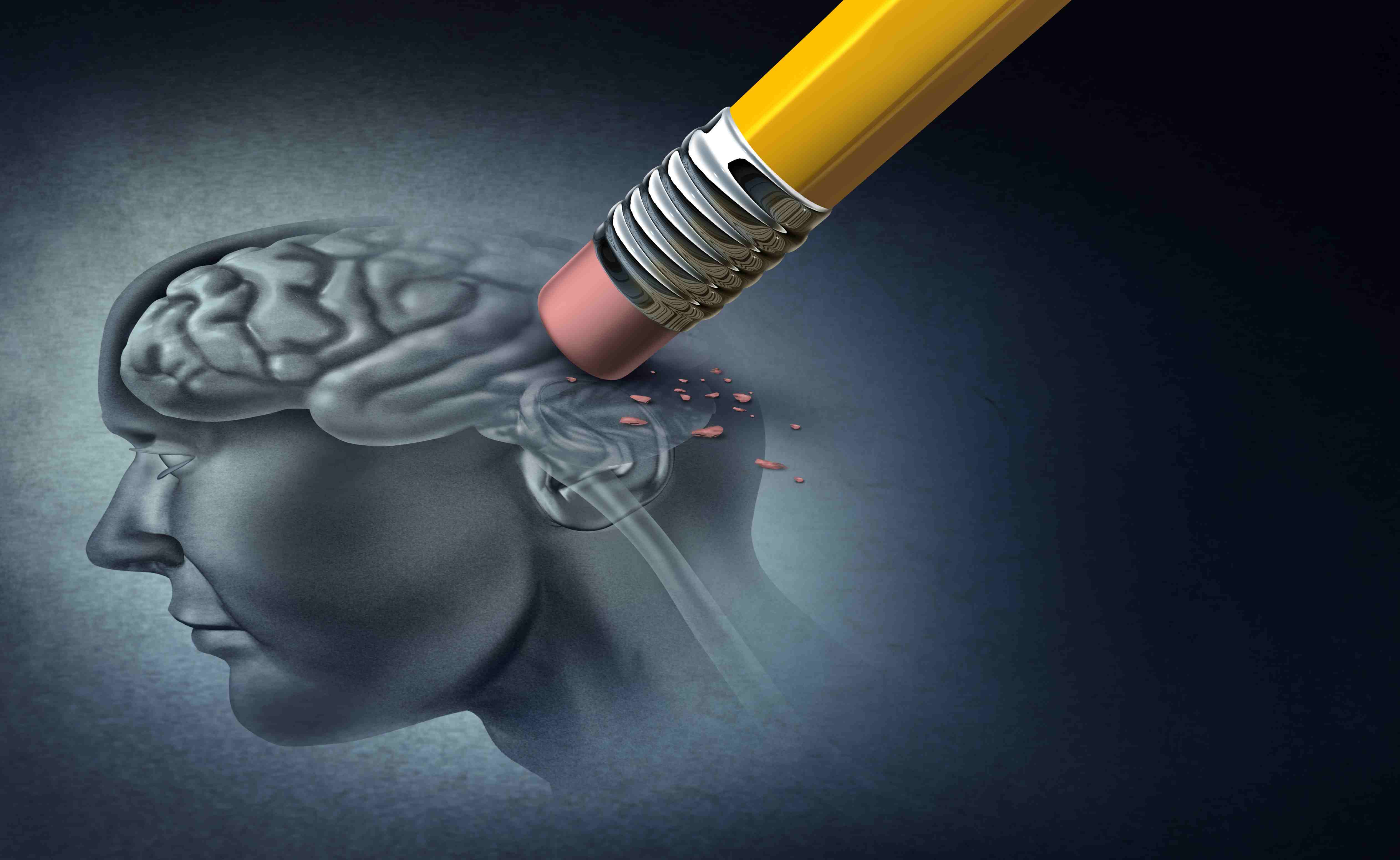 alzheimerova choroba 5